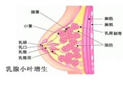 乳腺增生治療方法是什么？乳腺增生的檢查方法有哪些？