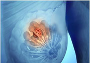 乳房有硬塊正常嗎？乳房有腫塊怎么回事？