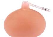 乳頭內(nèi)陷可以拔罐嗎？乳頭內(nèi)陷需要手術(shù)治療嗎？