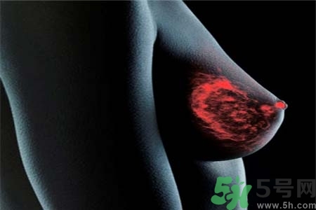 乳房上有硬塊怎么辦？乳房有硬塊的病因是什么？