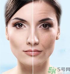 什么是3D液態(tài)拉皮？3D液態(tài)拉皮效果怎么樣？