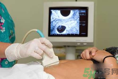 孕婦做b超要空腹嗎？孕婦做b超要不要空腹？