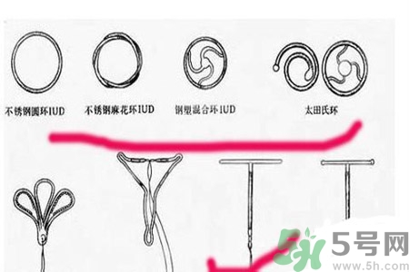 什么是宮內(nèi)節(jié)育器？放置宮內(nèi)節(jié)育器為什么能避孕？
