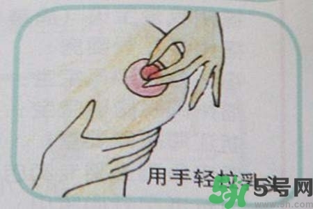 乳頭內(nèi)陷怎么矯正？乳頭內(nèi)陷矯正方法是什么？