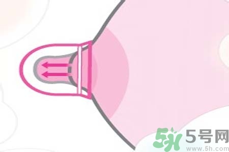 乳頭內(nèi)陷能不能喂奶？乳頭凹陷怎樣哺乳？