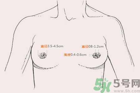 乳頭內(nèi)陷能不能喂奶？乳頭凹陷怎樣哺乳？