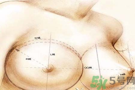 乳頭內(nèi)陷可以用吸奶器嗎？乳頭內(nèi)陷能不能用吸奶器？
