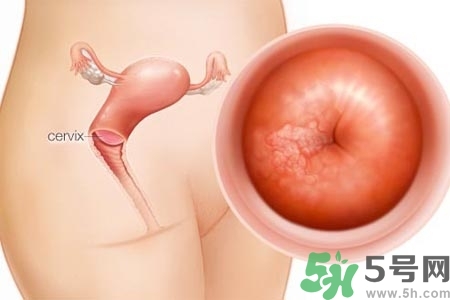 陰道干澀是什么？陰道干澀的危害有什么？