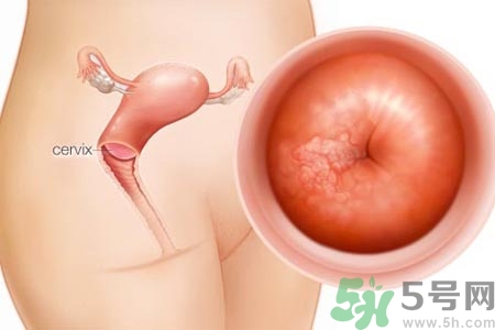 陰道干澀的原因是什么？陰道干澀怎么辦？