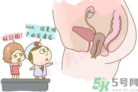 陰道松弛是什么？陰道松弛的癥狀有哪些？