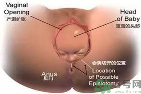 陰道松弛有什么危害？?陰道松弛恢復(fù)的方法有哪些？