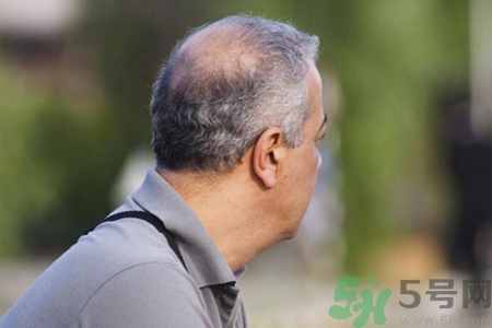 男性衰老的征兆有哪些？男性10個(gè)難以逆轉(zhuǎn)的衰老征兆