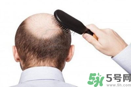 男性防止性衰老決竅有哪些？男性受用一生抵抗衰老法則