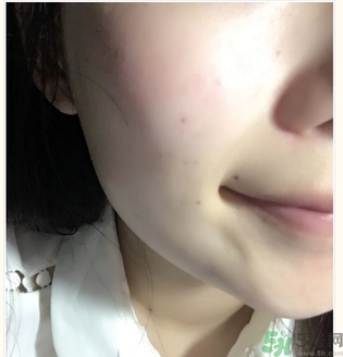 麗得姿面膜適合孕婦可以用嗎？麗得姿面膜哪些孕婦可以用？