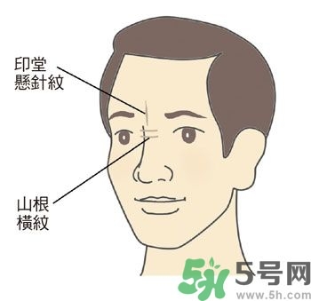 耳垂上有豎紋是怎么回事？山根有橫紋是什么?。?></p><h3>山根</h3><p>鼻尖是臉部最高的部位，就像山峰一樣，而位於兩眼內(nèi)側(cè)眼頭之間的鼻梁低處，是鼻子開(kāi)始要隆起的地方，相對(duì)於鼻子高度最低，所以稱(chēng)為「山根」，它與心臟關(guān)系最密切。正常的山根，高度應(yīng)該與鼻子和面部的比例相合，而且要有隆起的樣子，光滑無(wú)橫紋，沒(méi)有青筋。</p><p>許多壯年猝死的人，如人稱(chēng)科技游俠的溫世仁先生（腦干出血），藝人戎祥、馬兆駿（心肌梗塞）等，他們的山根都比較低陷，幾乎與兩側(cè)的眼頭一樣高。</p><p>●山根低陷或出現(xiàn)橫向細(xì)紋：山根低陷除非是外傷，否則通常是先天的結(jié)構(gòu)；山根橫紋則常在身體使用多年、身心壓力大的中年以後出現(xiàn)，而且多兼有皺眉的習(xí)慣。</p><p>●山根青筋：較常出現(xiàn)在小孩子身上，表示曾受驚嚇，心神不安，睡覺(jué)時(shí)多會(huì)翻覆，情緒比較不太穩(wěn)定。</p><p style=