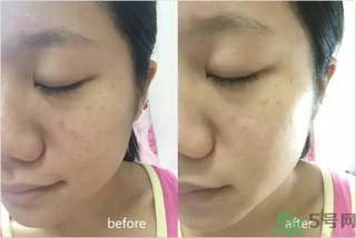 rilastil面膜使用方法 維納斯蒂爾面膜怎么用？
