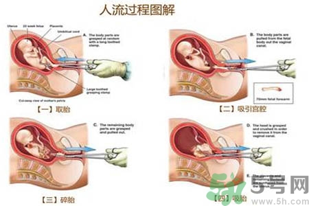 人流后怎么調(diào)養(yǎng)身體？人流后飲食需注意什么？
