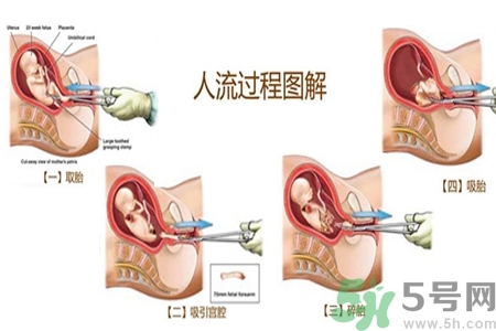 人流后怎么調(diào)養(yǎng)身體？人流后飲食需注意什么？