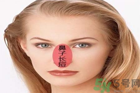 鼻翼長痘痘怎么辦？鼻翼長痘解決方法有哪些？