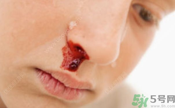 15歲男孩可以刮胡子嗎？15歲男孩經(jīng)常流鼻血怎么回事？