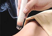 肩周炎艾灸有用嗎？肩周炎艾灸哪些部位？