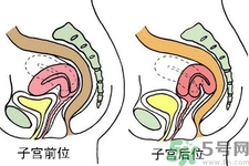 ?子宮移位怎么治療？子宮移位能懷孕嗎？