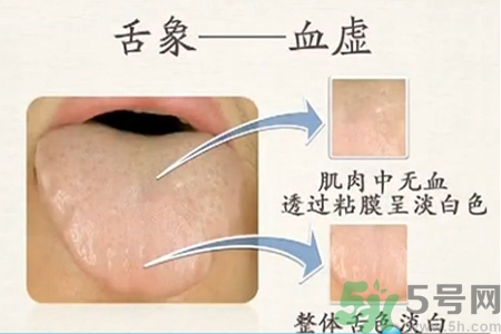 血虛怎么調(diào)理？女人血虛怎么調(diào)理？