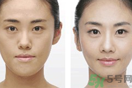 激光縮毛孔多少錢一次？激光縮毛孔一個療程多少錢？