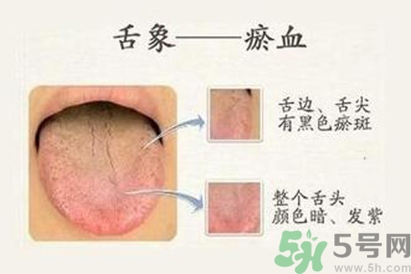 血瘀體質吃什么？血瘀體質怎么調理？