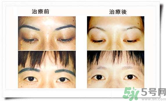 紋眉毛有什么危害？紋眉后注意事項