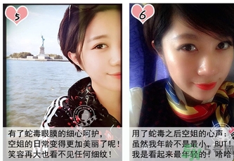 蛇毒眼膜孕婦可以用嗎？ 日本spa蛇毒眼膜孕婦能用嗎？