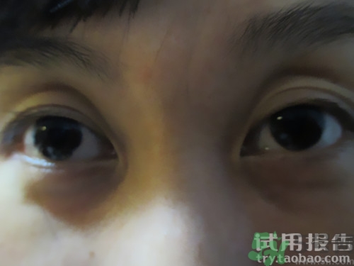 蛇毒眼膜效果怎么樣？spa蛇毒眼膜紅色好用嗎？