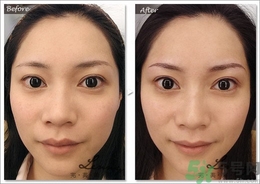 眉毛怎么整形好看？眉毛怎么整自然？