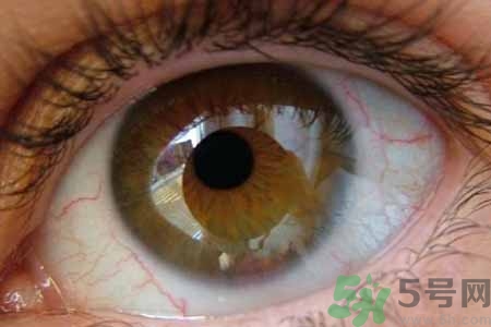 ?干眼癥的治療方法是什么？如何預(yù)防干眼癥？