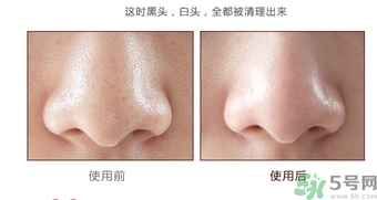 yu.r巧克力棒鼻貼怎么樣？yu.r巧克力鼻貼好用嗎？