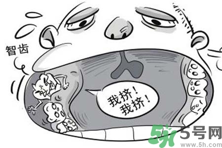 智齒橫著長(zhǎng)怎么辦？智齒橫著長(zhǎng)一定要拔了嗎？