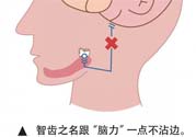 長智齒疼痛怎么辦？長智齒牙齦腫了怎么辦？