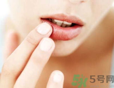 孕婦嘴唇干裂脫皮怎么回事？孕婦嘴唇干裂脫皮是缺什么
