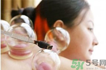 月經(jīng)可以拔火罐嗎？經(jīng)期可以拔火罐嗎？