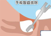 智齒拔完后有個洞怎么辦？拔智齒后有個洞多久能長好？