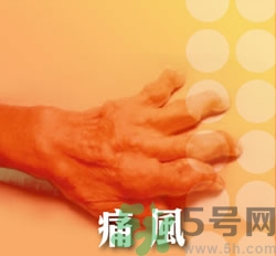 骨關(guān)節(jié)炎能治好嗎？骨關(guān)節(jié)炎平時注意事項