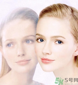 曬斑可以自己消退嗎？曬斑可以用激光去除嗎？