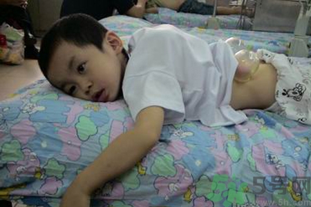 小孩可以拔罐嗎？寶寶能拔火罐嗎？