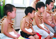 小孩可以拔罐嗎？寶寶能拔火罐嗎？