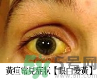上腹部不舒服有時(shí)疼痛會(huì)不會(huì)是胰臟癌？