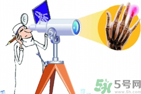 什么年齡測(cè)骨齡最好？如何測(cè)骨齡？