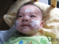 新生兒濕疹可以用爐甘石洗劑嗎？新生兒濕疹的護(hù)理措施
