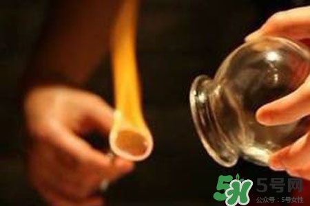 拔罐放血對(duì)身體好嗎？拔罐放血有什么好處？