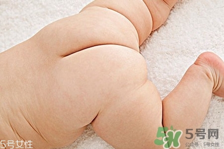 擴(kuò)肛有什么好處？擴(kuò)肛需要注意什么？
