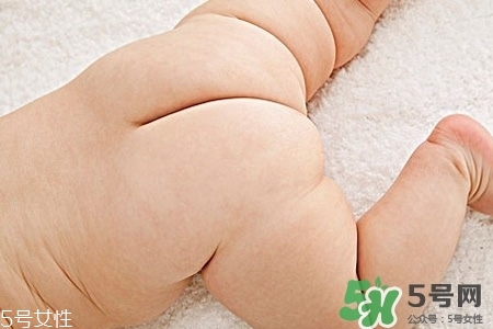 擴肛疼嗎？擴肛手術(shù)會很疼嗎？